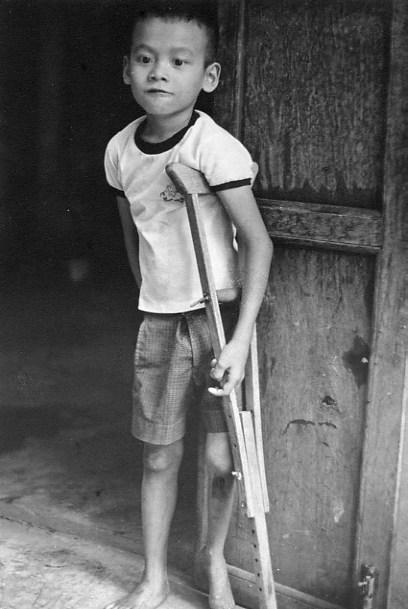 Polio victim. Lived with another volunteer for awhile.